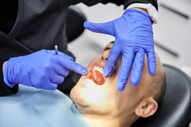 Best Emergency Tooth Extraction in Six Mile, SC